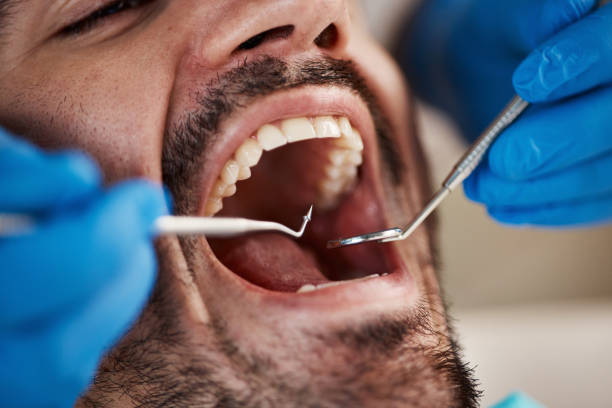 Emergency Dental Services in Pitman, NJ